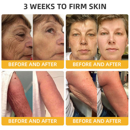 Bee Venom Retinol Skin Salve Ointment 🐝𝐀𝐀𝐃 𝐑𝐄𝐂𝐎𝐌𝐌𝐄𝐍𝐃𝐒(🔥55% Off for a Limited Time!)