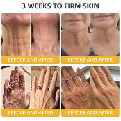Bee Venom Retinol Skin Salve Ointment 🐝𝐀𝐀𝐃 𝐑𝐄𝐂𝐎𝐌𝐌𝐄𝐍𝐃𝐒(🔥55% Off for a Limited Time!)