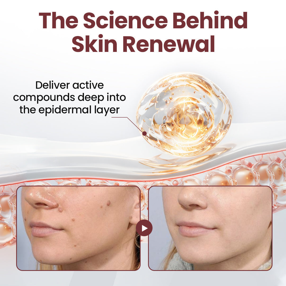 𝑶𝒇𝒇𝒊𝒄𝒊𝒂𝒍 𝑺𝒕𝒐𝒓𝒆 | 🏵️𝐑𝐨𝐩𝐜𝐞𝐞𝐫® KeraErase Dual-Action Renewal Cream 🇺🇸🕊️(Dual-Action Renewal – Softens raised bumps and breaks down deep keratin buildup without acids or irritation)