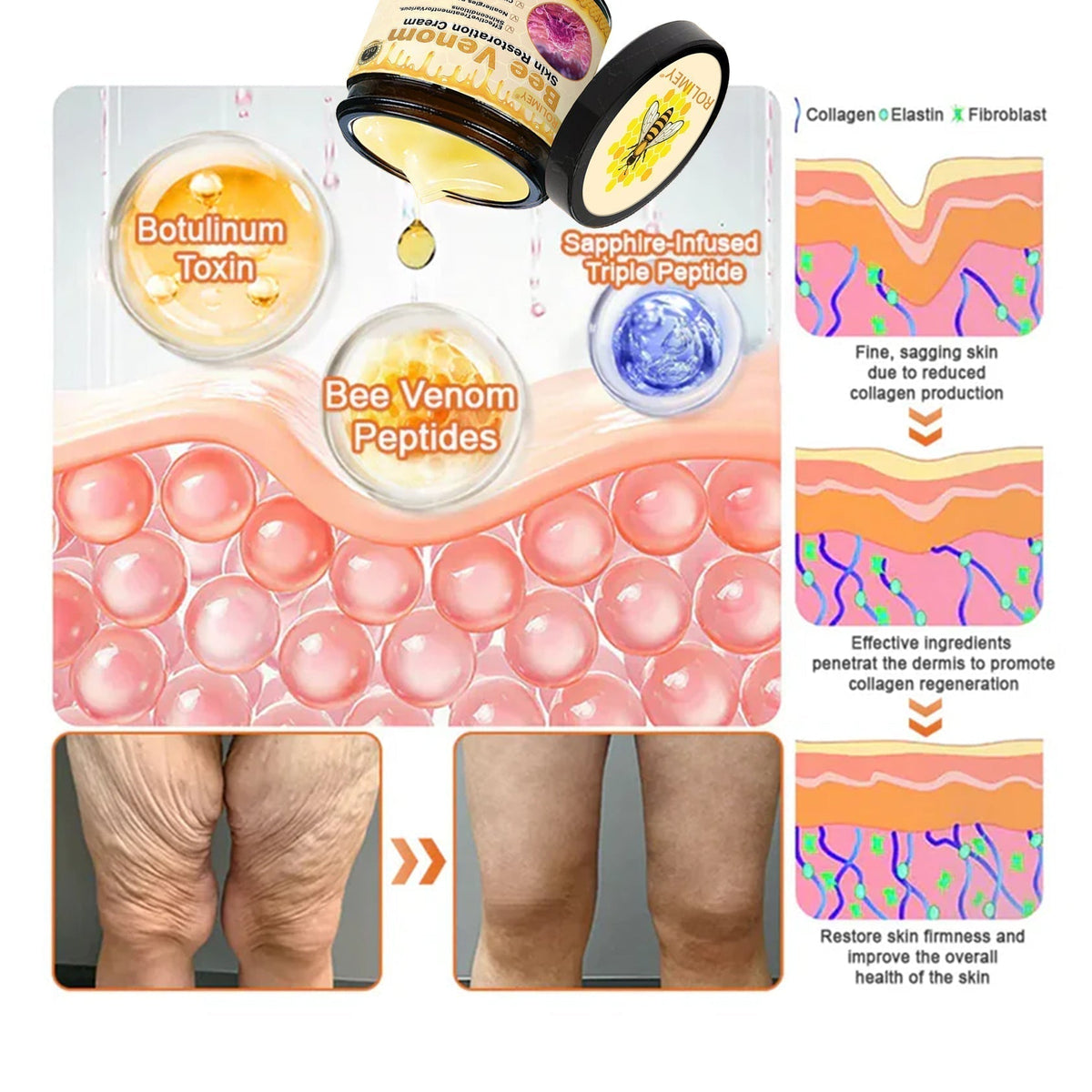 👍Official Brand Shop 丨Rolimey® Bee venom Pro Comprehensive Cream