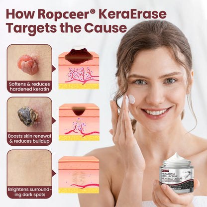 𝑶𝒇𝒇𝒊𝒄𝒊𝒂𝒍 𝑺𝒕𝒐𝒓𝒆 | 🏵️𝐑𝐨𝐩𝐜𝐞𝐞𝐫® KeraErase Dual-Action Renewal Cream 🇺🇸🕊️(Dual-Action Renewal – Softens raised bumps and breaks down deep keratin buildup without acids or irritation)