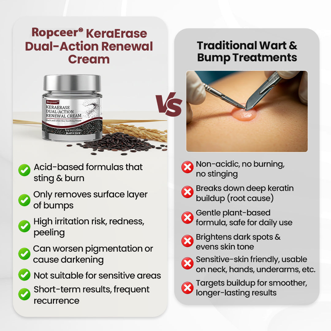 𝑶𝒇𝒇𝒊𝒄𝒊𝒂𝒍 𝑺𝒕𝒐𝒓𝒆 | 🏵️𝐑𝐨𝐩𝐜𝐞𝐞𝐫® KeraErase Dual-Action Renewal Cream 🇺🇸🕊️(Dual-Action Renewal – Softens raised bumps and breaks down deep keratin buildup without acids or irritation)