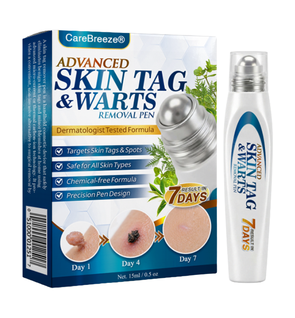 🇺🇸 CureVivo® Advanced Skin Tag & Wart Removal Roller 🧑🏼‍⚕️